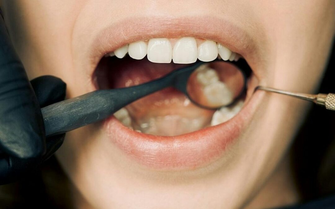 Use Your Dental Benefits Before Year-End